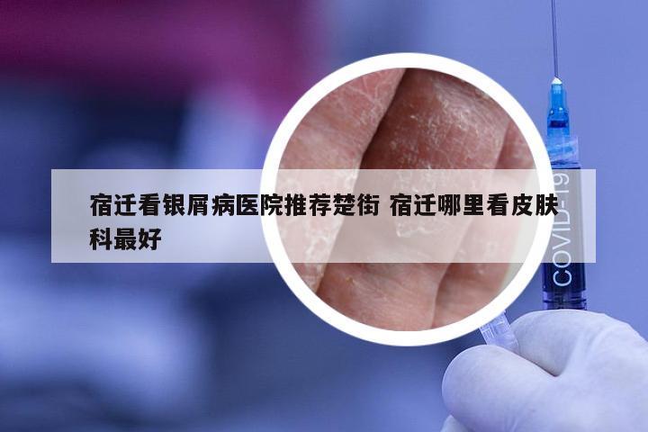 宿迁看银屑病医院推荐楚街 宿迁哪里看皮肤科最好