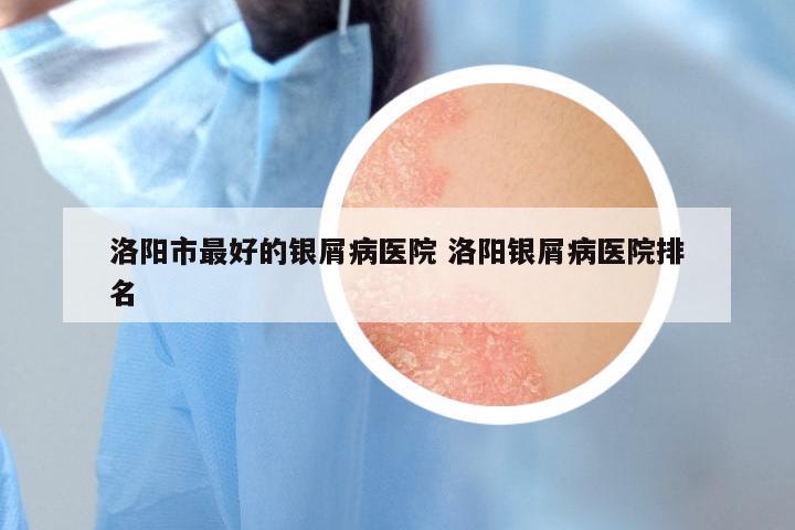 洛阳市最好的银屑病医院 洛阳银屑病医院排名