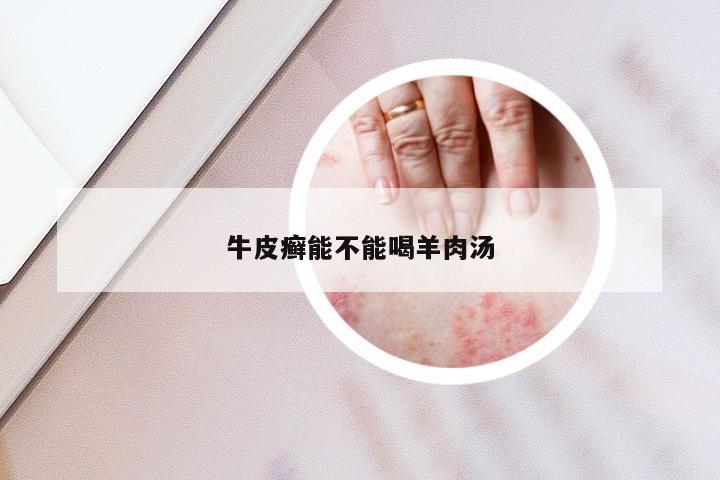 牛皮癣能不能喝羊肉汤