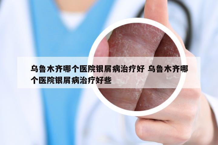 乌鲁木齐哪个医院银屑病治疗好 乌鲁木齐哪个医院银屑病治疗好些