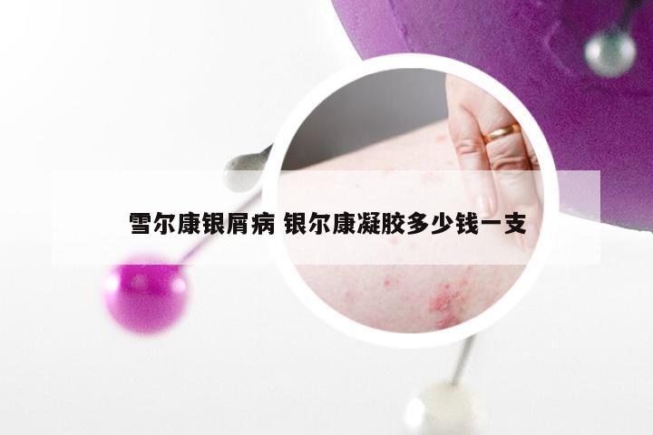 雪尔康银屑病 银尔康凝胶多少钱一支