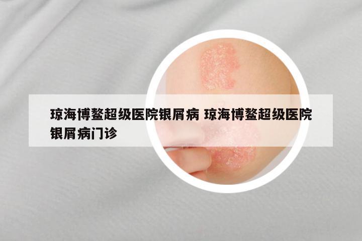 琼海博鳌超级医院银屑病 琼海博鳌超级医院银屑病门诊