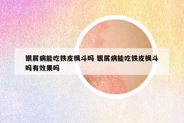 银屑病能吃铁皮枫斗吗 银屑病能吃铁皮枫斗吗有效果吗