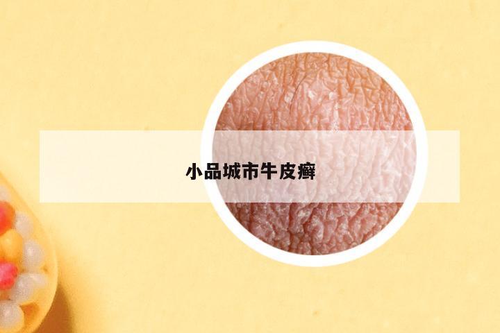 小品城市牛皮癣