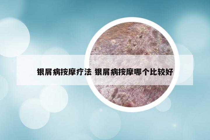 银屑病按摩疗法 银屑病按摩哪个比较好