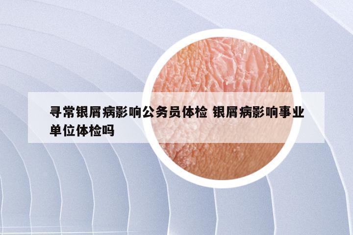 寻常银屑病影响公务员体检 银屑病影响事业单位体检吗
