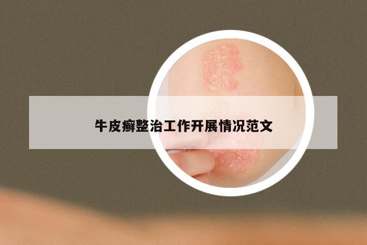 牛皮癣整治工作开展情况范文