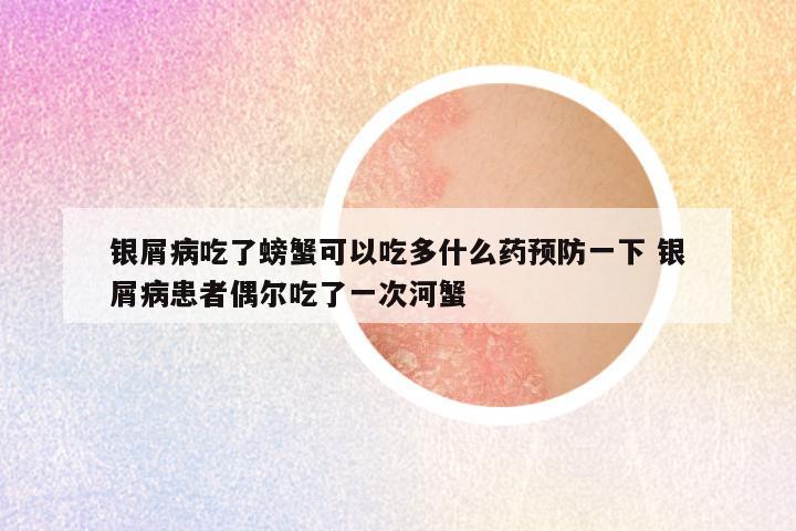 银屑病吃了螃蟹可以吃多什么药预防一下 银屑病患者偶尔吃了一次河蟹