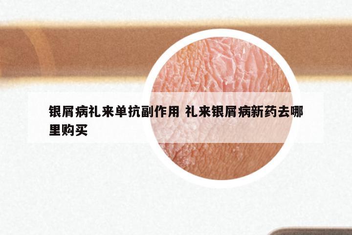 银屑病礼来单抗副作用 礼来银屑病新药去哪里购买