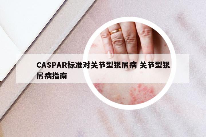 CASPAR标准对关节型银屑病 关节型银屑病指南
