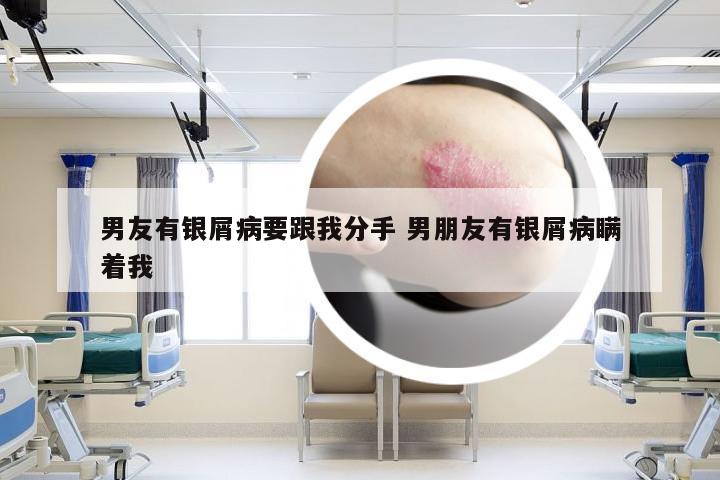 男友有银屑病要跟我分手 男朋友有银屑病瞒着我
