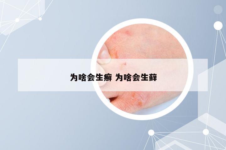 为啥会生癣 为啥会生藓