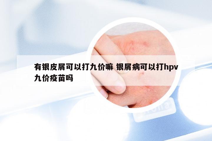 有银皮屑可以打九价嘛 银屑病可以打hpv九价疫苗吗
