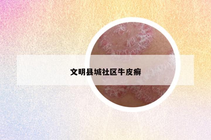 文明县城社区牛皮癣