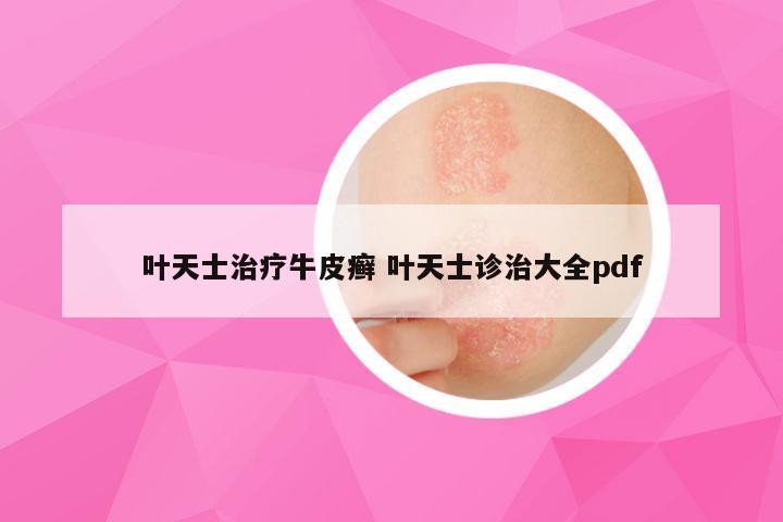 叶天士治疗牛皮癣 叶天士诊治大全pdf