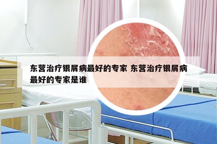 东营治疗银屑病最好的专家 东营治疗银屑病最好的专家是谁