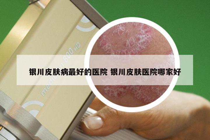 银川皮肤病最好的医院 银川皮肤医院哪家好