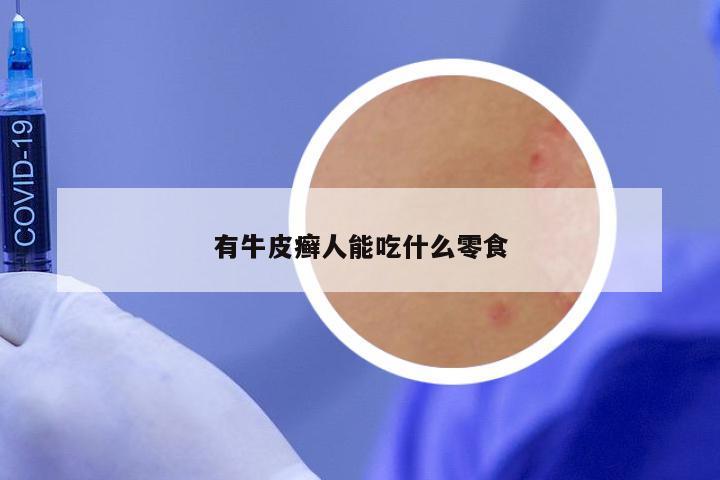 有牛皮癣人能吃什么零食