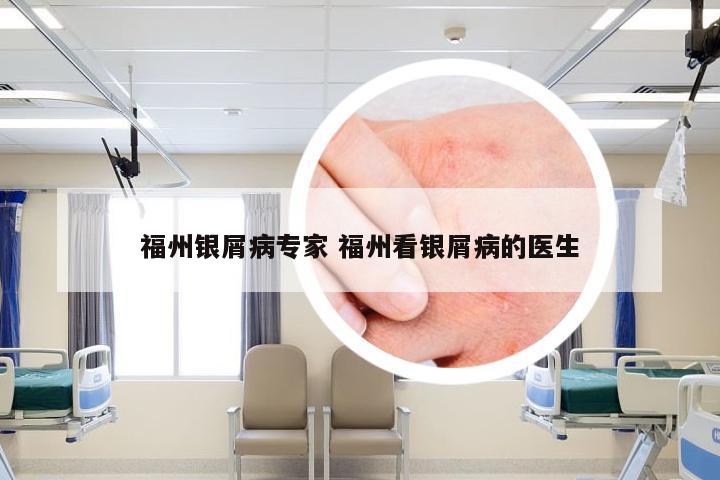 福州银屑病专家 福州看银屑病的医生