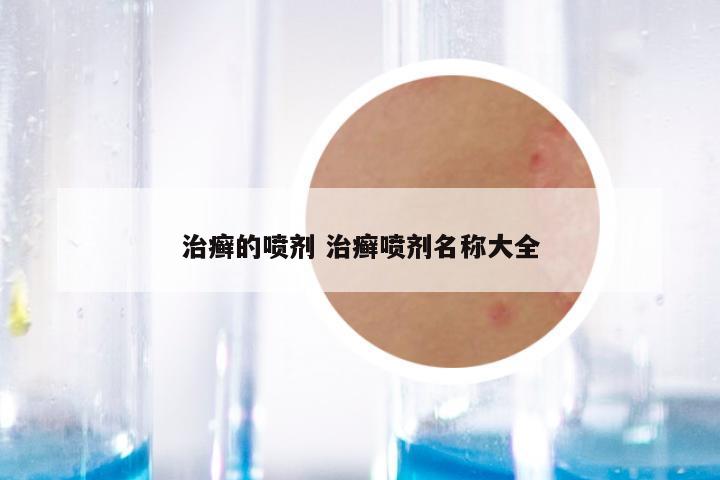 治癣的喷剂 治癣喷剂名称大全