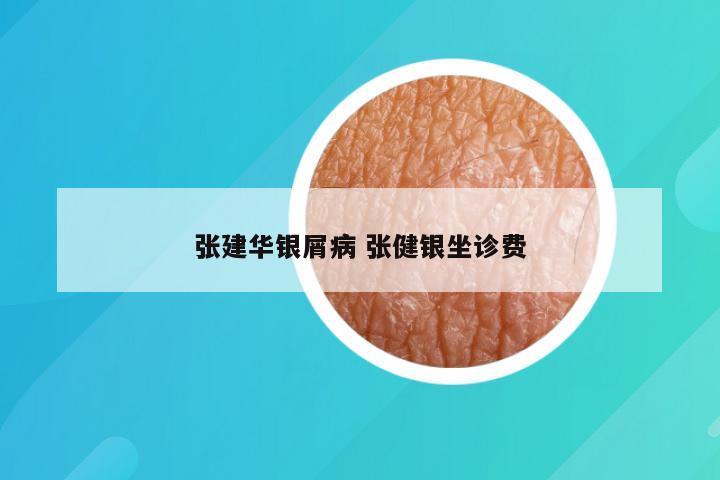 张建华银屑病 张健银坐诊费