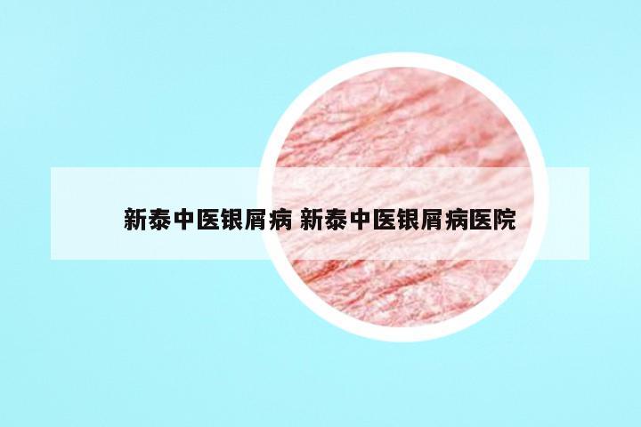 新泰中医银屑病 新泰中医银屑病医院