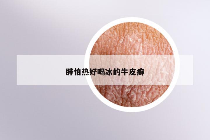 胖怕热好喝冰的牛皮癣