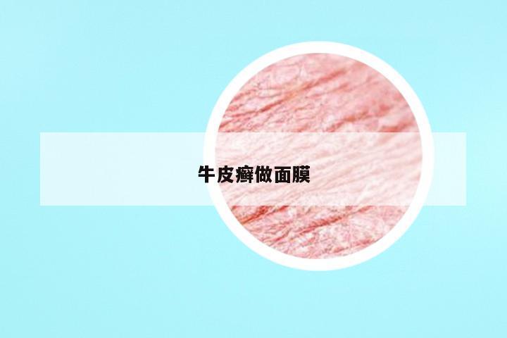 牛皮癣做面膜