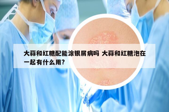 大蒜和红糖配能涂银屑病吗 大蒜和红糖泡在一起有什么用?