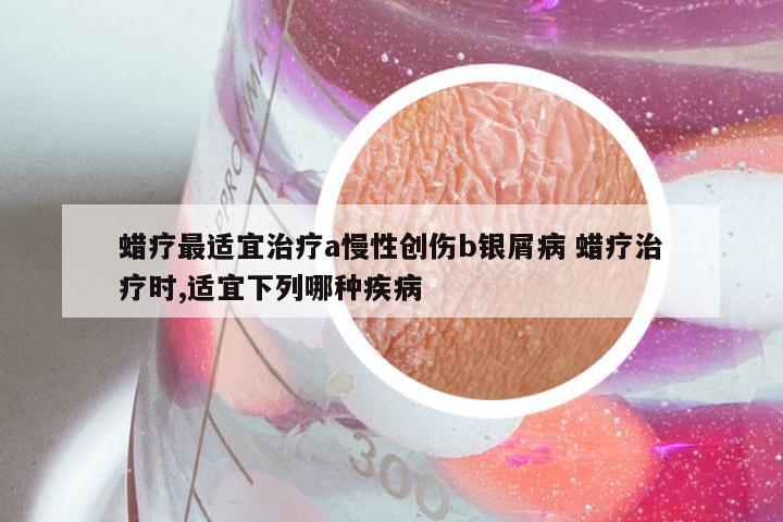 蜡疗最适宜治疗a慢性创伤b银屑病 蜡疗治疗时,适宜下列哪种疾病