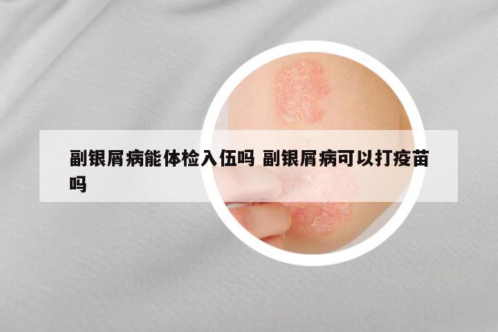 副银屑病能体检入伍吗 副银屑病可以打疫苗吗
