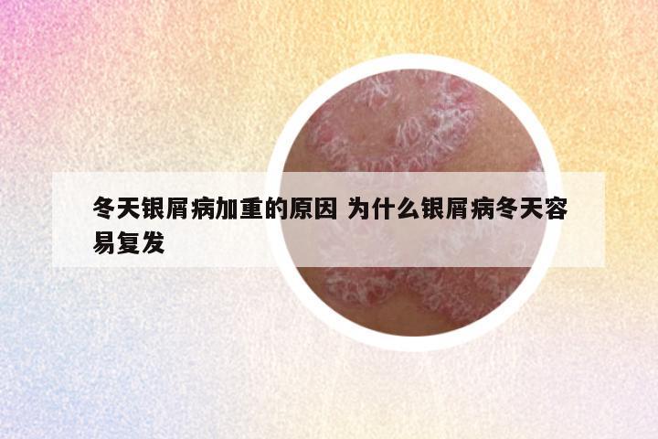 冬天银屑病加重的原因 为什么银屑病冬天容易复发