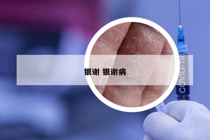 银谢 银谢病