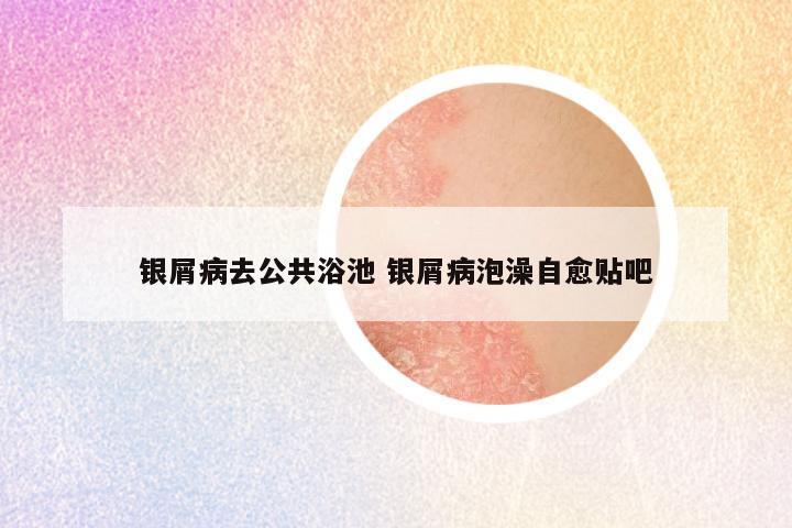 银屑病去公共浴池 银屑病泡澡自愈贴吧