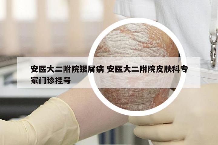安医大二附院银屑病 安医大二附院皮肤科专家门诊挂号