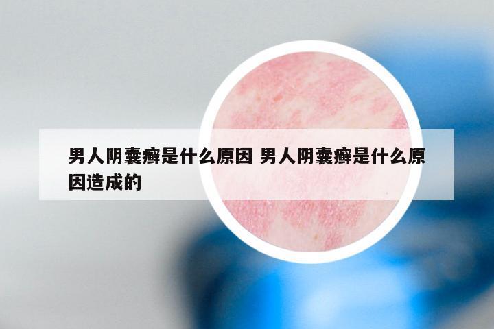 男人阴囊癣是什么原因 男人阴囊癣是什么原因造成的
