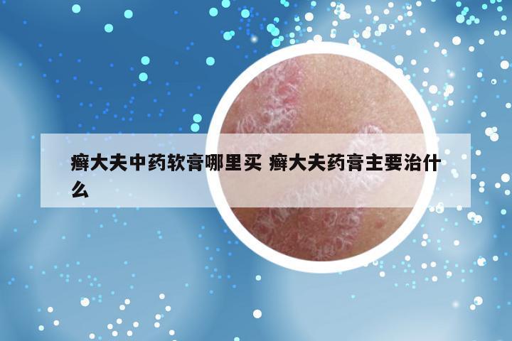 癣大夫中药软膏哪里买 癣大夫药膏主要治什么