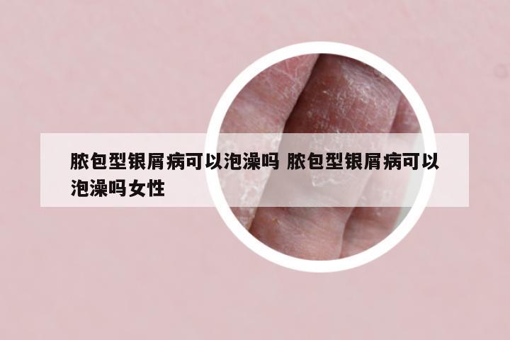 脓包型银屑病可以泡澡吗 脓包型银屑病可以泡澡吗女性