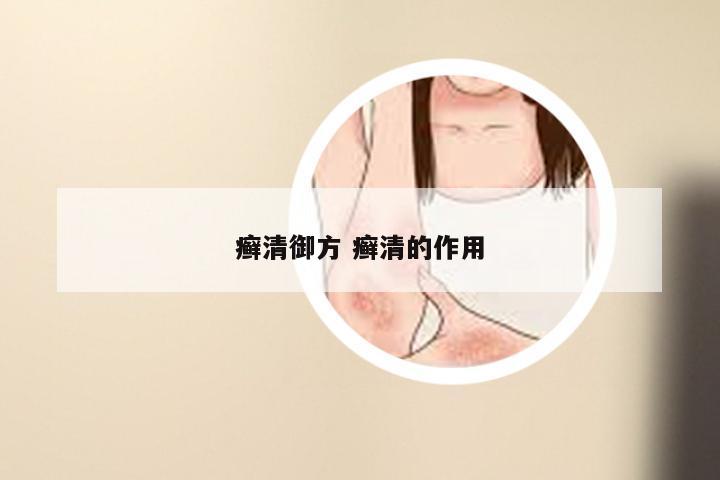 癣清御方 癣清的作用