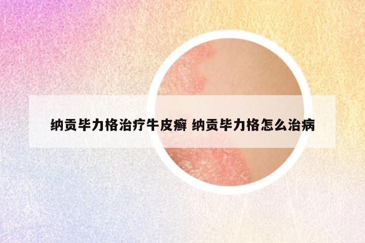 纳贡毕力格治疗牛皮癣 纳贡毕力格怎么治病