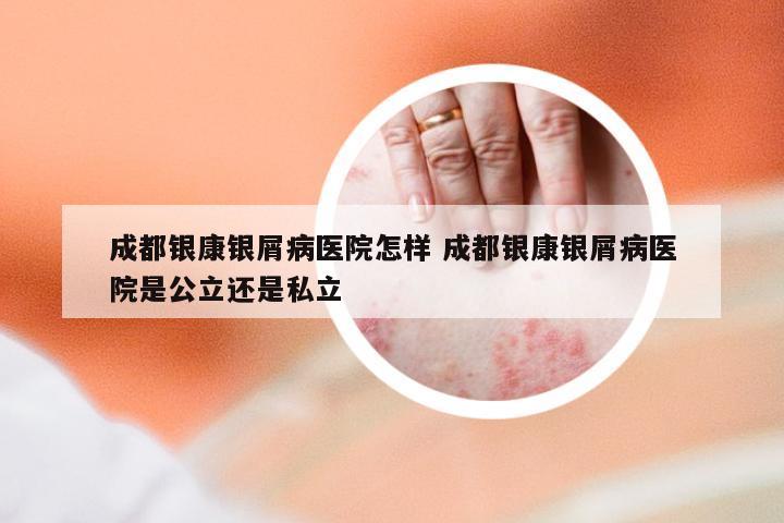 成都银康银屑病医院怎样 成都银康银屑病医院是公立还是私立