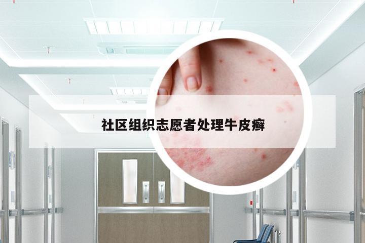 社区组织志愿者处理牛皮癣