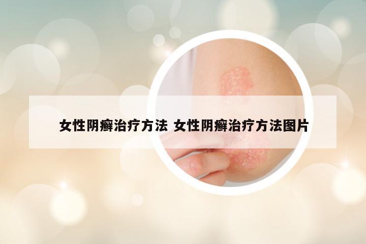 女性阴癣治疗方法 女性阴癣治疗方法图片
