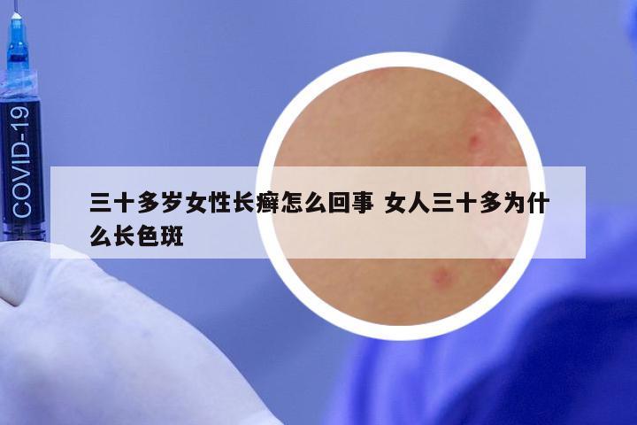 三十多岁女性长癣怎么回事 女人三十多为什么长色斑