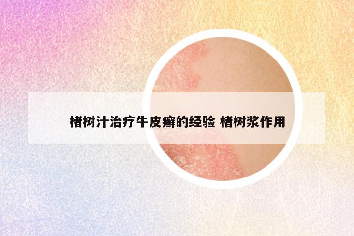 楮树汁治疗牛皮癣的经验 楮树浆作用
