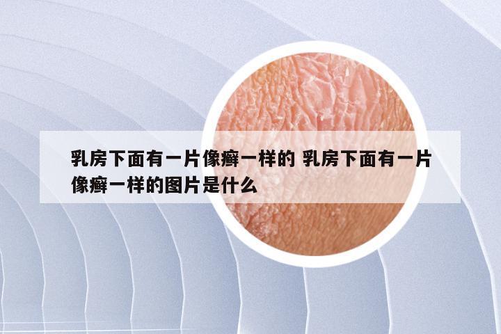 乳房下面有一片像癣一样的 乳房下面有一片像癣一样的图片是什么