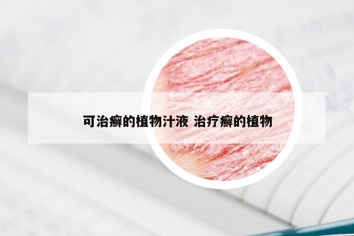 可治癣的植物汁液 治疗癣的植物