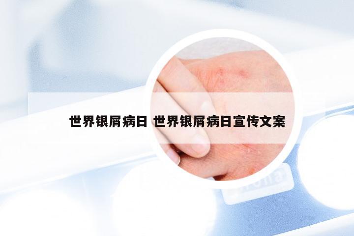 世界银屑病日 世界银屑病日宣传文案