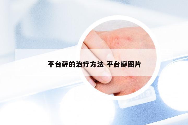 平台藓的治疗方法 平台癣图片