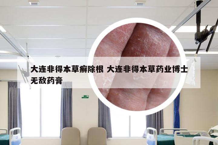 大连非得本草癣除根 大连非得本草药业博士无敌药膏